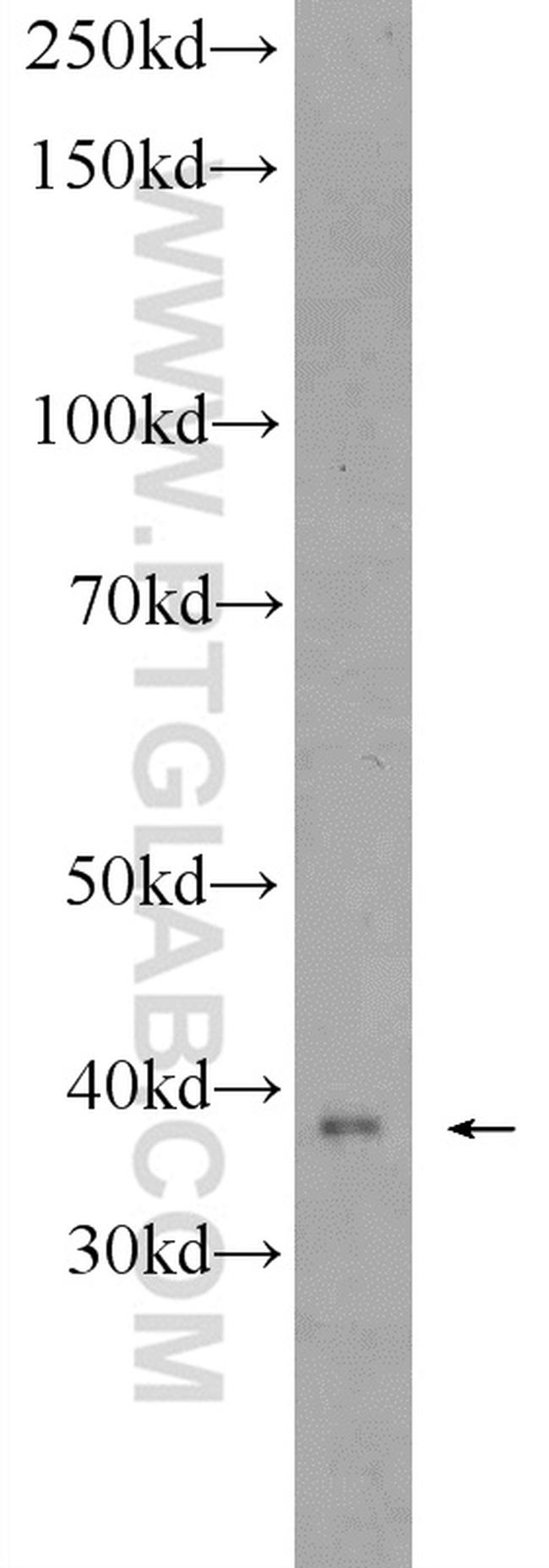 ZDHHC9 Antibody in Western Blot (WB)