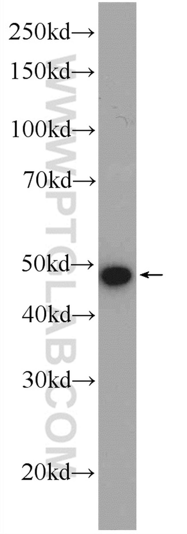 ZDHHC9 Antibody in Western Blot (WB)