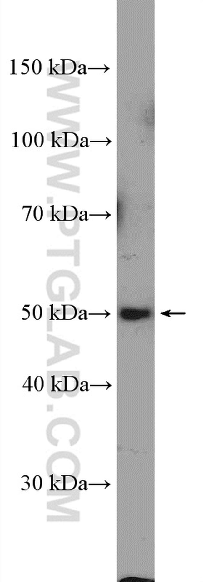 ZDHHC9 Antibody in Western Blot (WB)