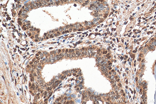 Glucocorticoid receptor Antibody in Immunohistochemistry (Paraffin) (IHC (P))