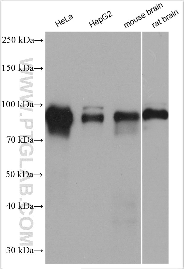 Glucocorticoid receptor Antibody in Western Blot (WB)