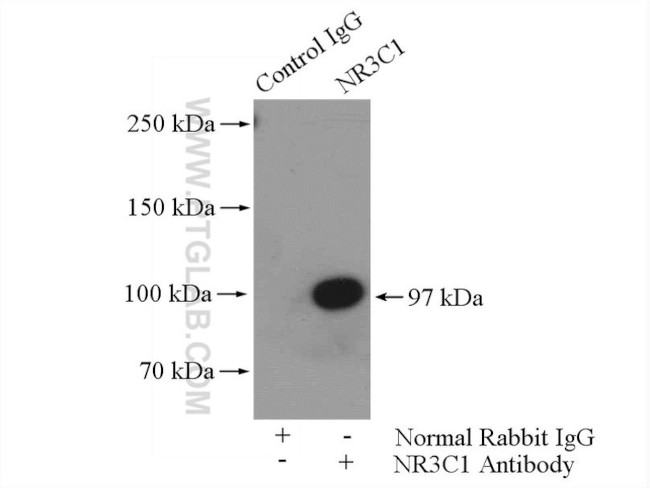 Glucocorticoid receptor Antibody in Immunoprecipitation (IP)