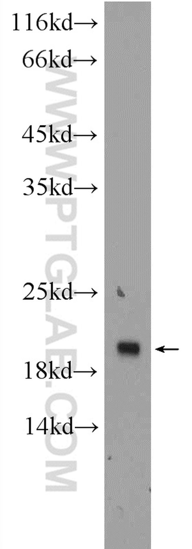 TMEM27 Antibody in Western Blot (WB)