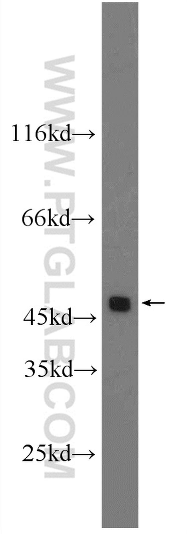 DR4 Antibody in Western Blot (WB)