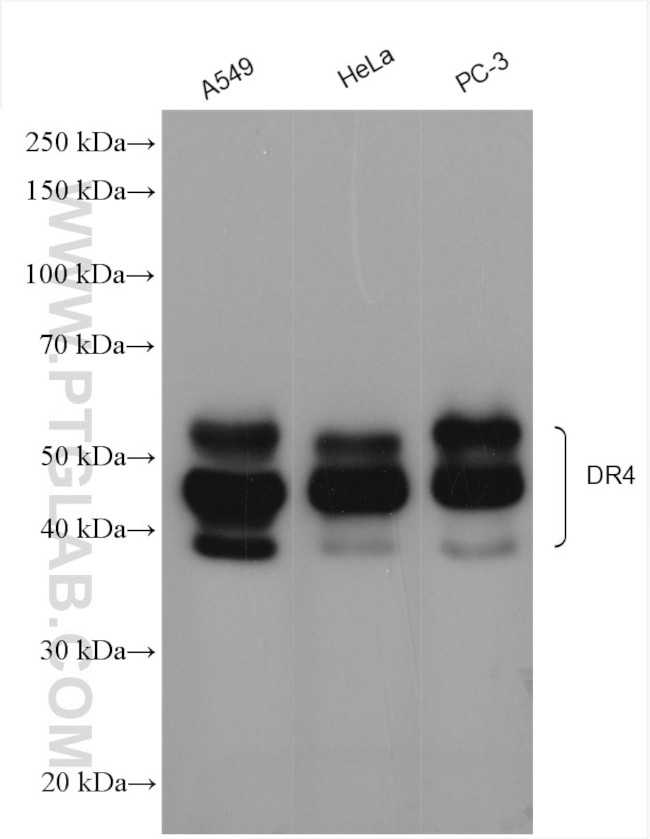 DR4 Antibody in Western Blot (WB)