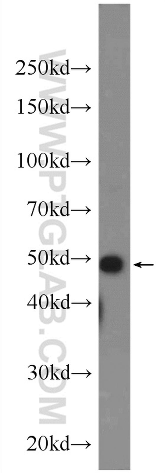 DR4 Antibody in Western Blot (WB)