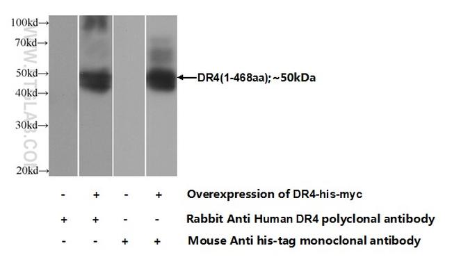 DR4 Antibody in Western Blot (WB)