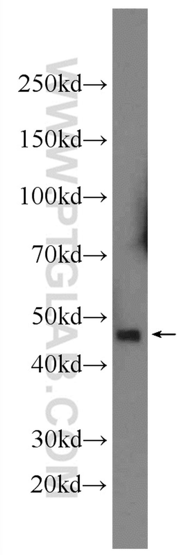 DR4 Antibody in Western Blot (WB)