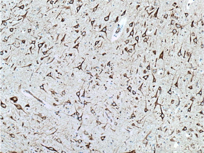 NHEDC2 Antibody in Immunohistochemistry (Paraffin) (IHC (P))