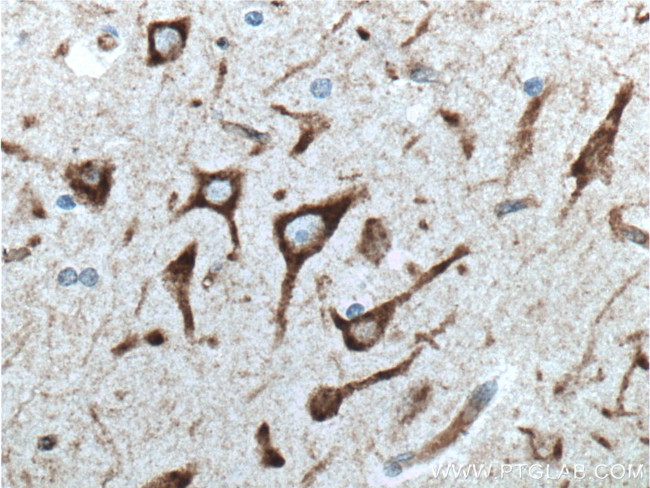 NHEDC2 Antibody in Immunohistochemistry (Paraffin) (IHC (P))