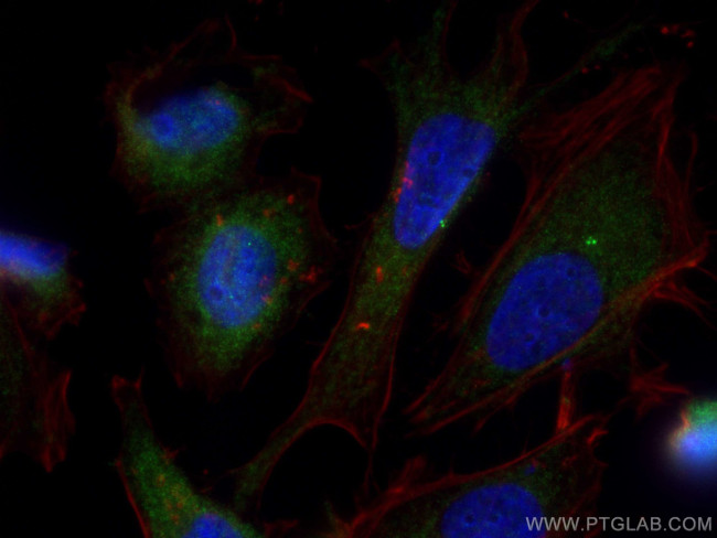 CEP120 Antibody in Immunocytochemistry (ICC/IF)