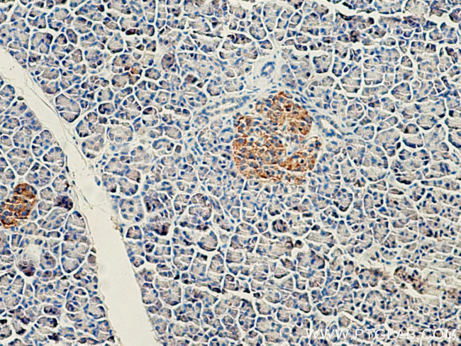 CEP120 Antibody in Immunohistochemistry (Paraffin) (IHC (P))