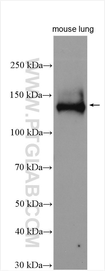 CEP120 Antibody in Western Blot (WB)