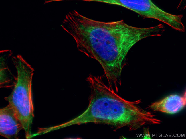 Rac1 Antibody in Immunocytochemistry (ICC/IF)