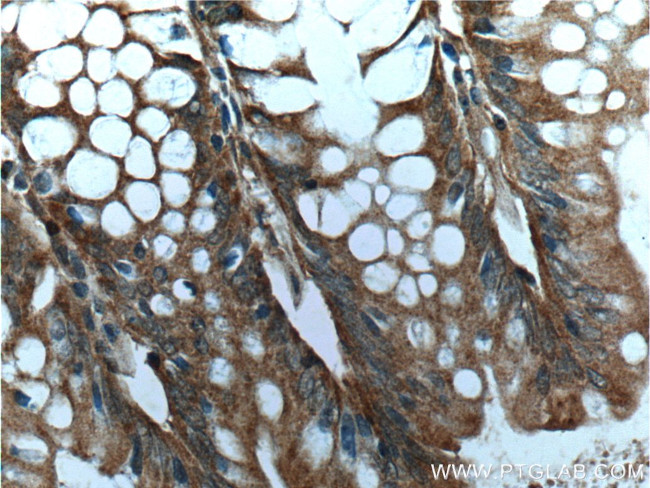 Rac1 Antibody in Immunohistochemistry (Paraffin) (IHC (P))