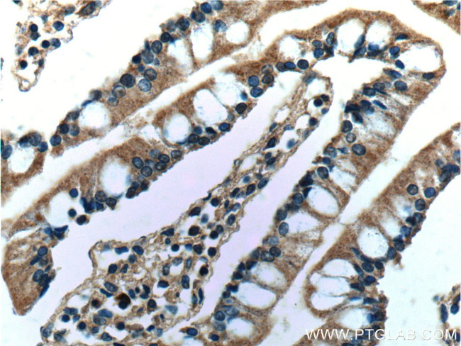 Rac1 Antibody in Immunohistochemistry (Paraffin) (IHC (P))