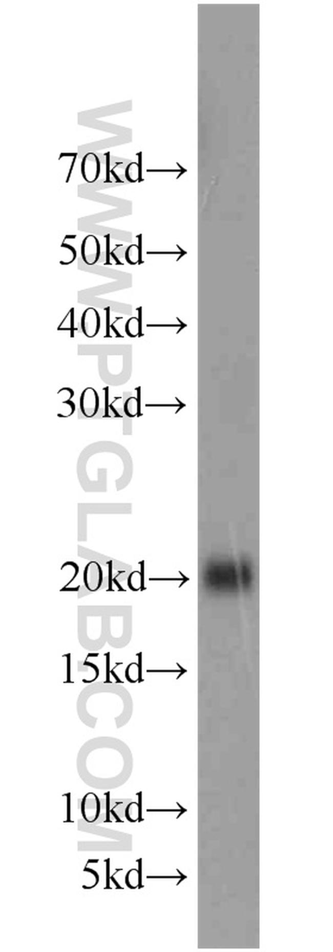 Rac1 Antibody in Western Blot (WB)