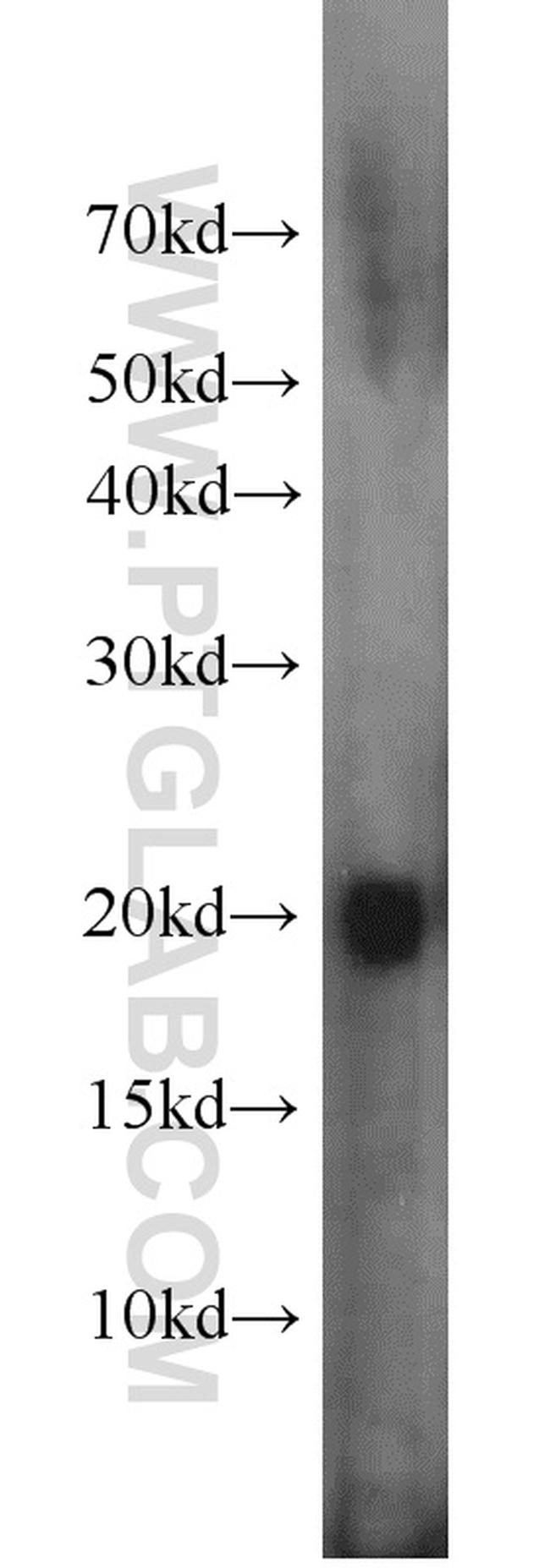 Rac1 Antibody in Western Blot (WB)