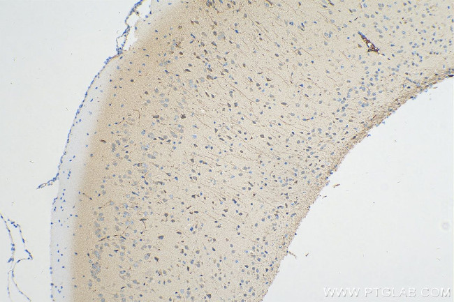 TSNARE1 Antibody in Immunohistochemistry (Paraffin) (IHC (P))