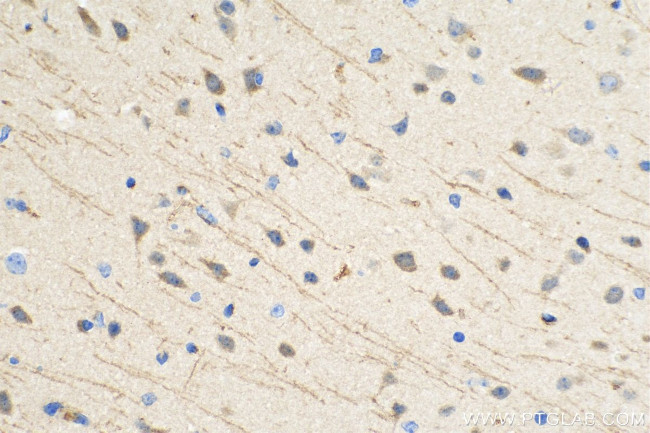 TSNARE1 Antibody in Immunohistochemistry (Paraffin) (IHC (P))