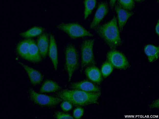 SPRED2 Antibody in Immunocytochemistry (ICC/IF)