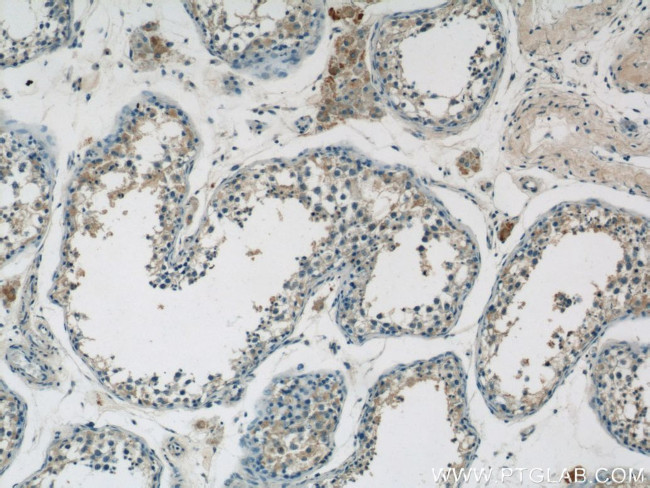 SPRED2 Antibody in Immunohistochemistry (Paraffin) (IHC (P))