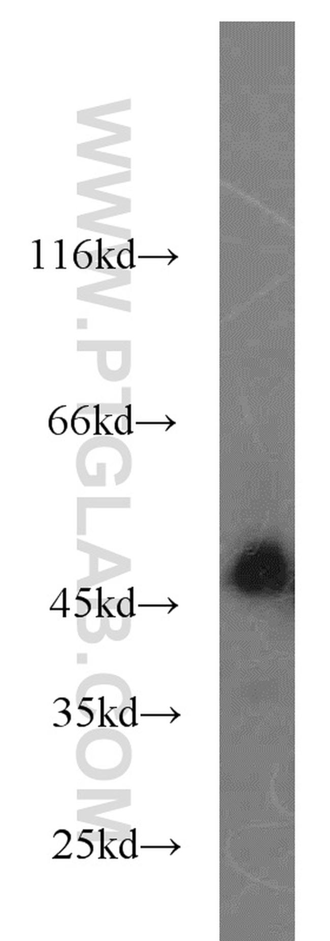 SPRED2 Antibody in Western Blot (WB)