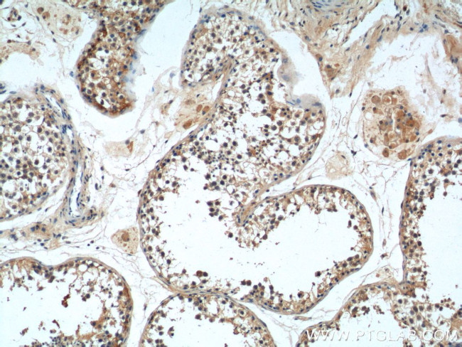 MAGEF1 Antibody in Immunohistochemistry (Paraffin) (IHC (P))