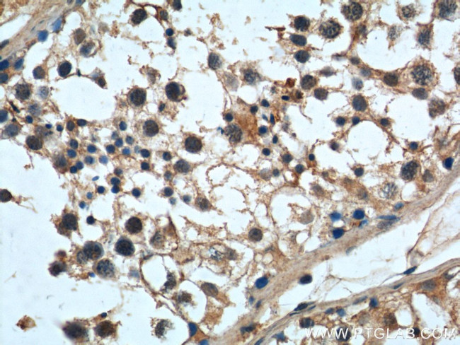 MAGEF1 Antibody in Immunohistochemistry (Paraffin) (IHC (P))