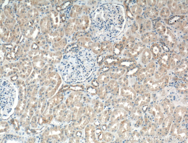 Cd2ap Antibody in Immunohistochemistry (Paraffin) (IHC (P))