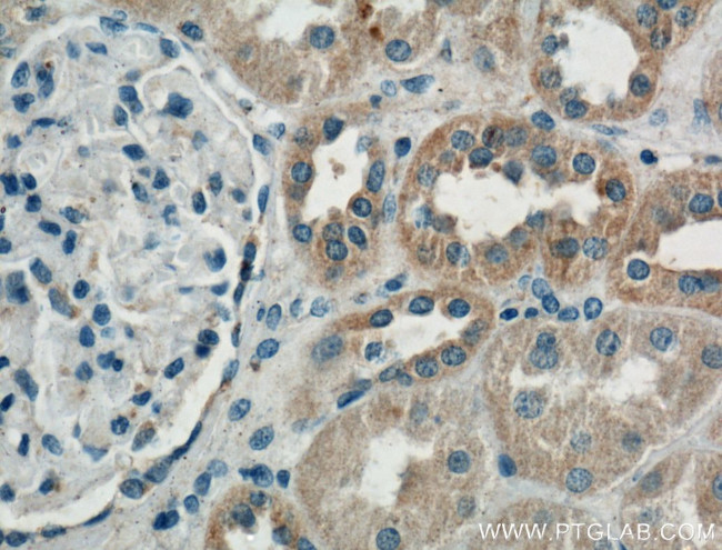 Cd2ap Antibody in Immunohistochemistry (Paraffin) (IHC (P))