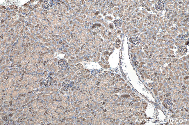 Cd2ap Antibody in Immunohistochemistry (Paraffin) (IHC (P))