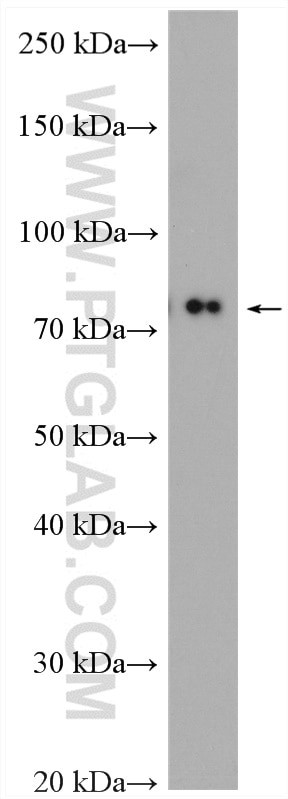 Cd2ap Antibody in Western Blot (WB)