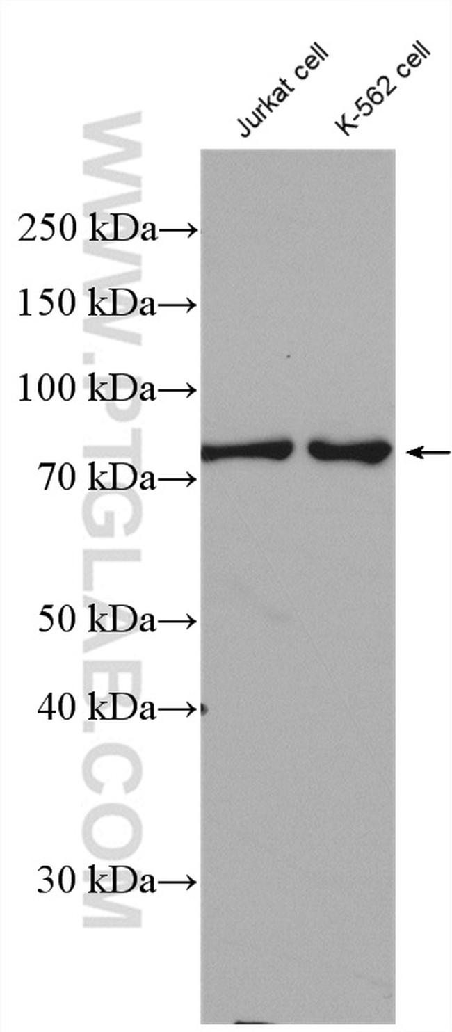 Cd2ap Antibody in Western Blot (WB)