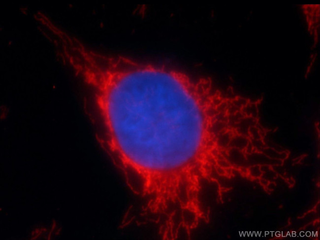 SOD2 Antibody in Immunocytochemistry (ICC/IF)