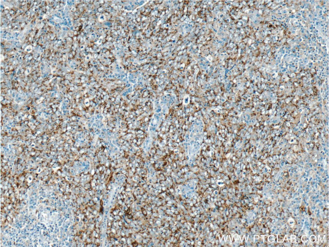 SOD2 Antibody in Immunohistochemistry (Paraffin) (IHC (P))