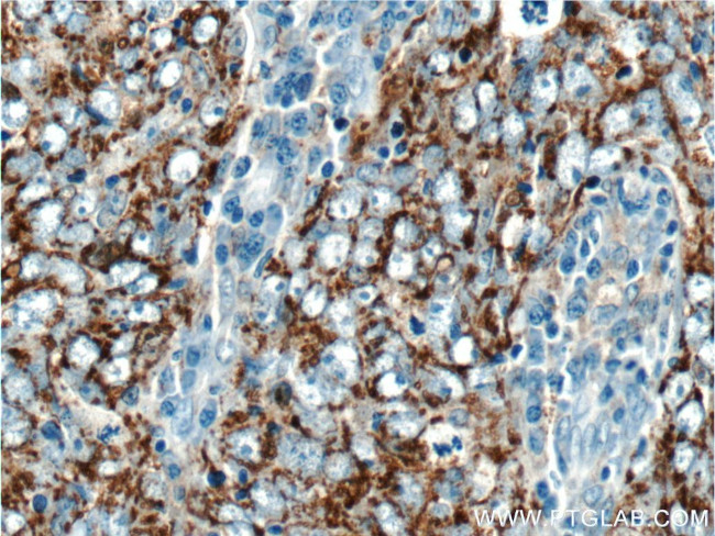 SOD2 Antibody in Immunohistochemistry (Paraffin) (IHC (P))