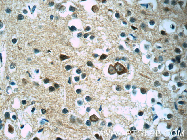 SOD2 Antibody in Immunohistochemistry (Paraffin) (IHC (P))