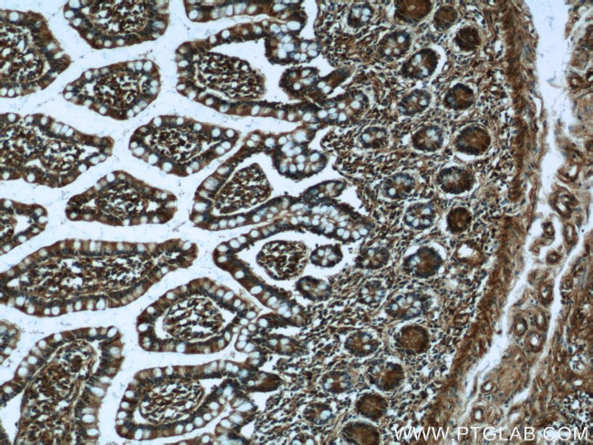 SOD2 Antibody in Immunohistochemistry (Paraffin) (IHC (P))