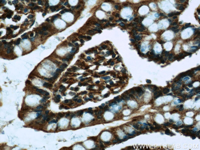 SOD2 Antibody in Immunohistochemistry (Paraffin) (IHC (P))