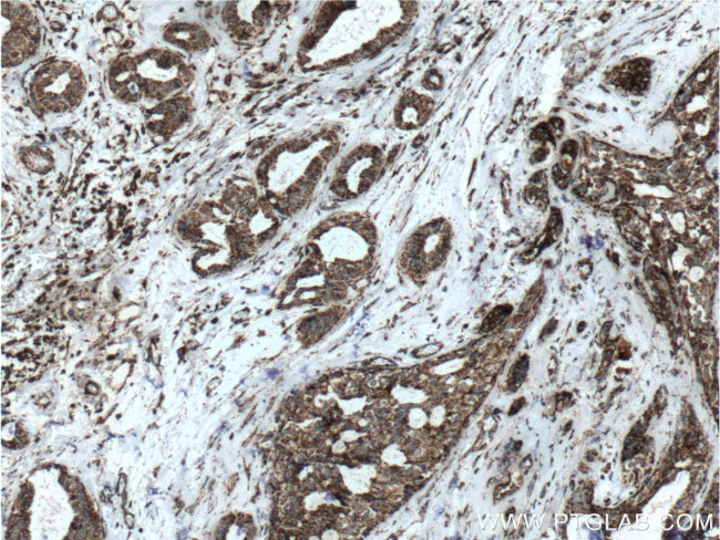 SOD2 Antibody in Immunohistochemistry (Paraffin) (IHC (P))