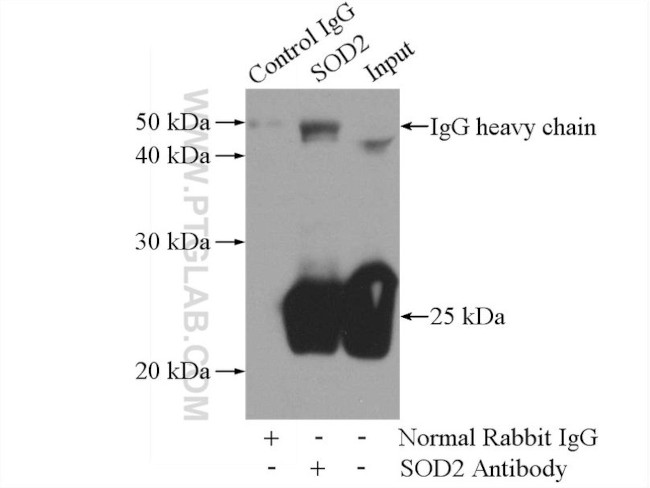 SOD2 Antibody in Immunoprecipitation (IP)