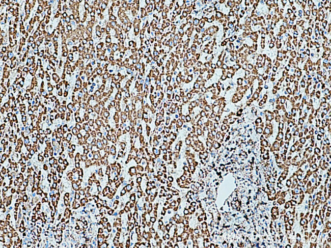 SOD2 Antibody in Immunohistochemistry (Paraffin) (IHC (P))