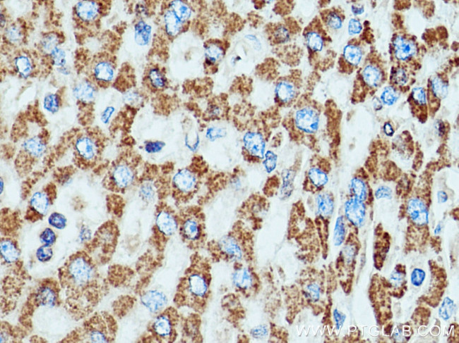 SOD2 Antibody in Immunohistochemistry (Paraffin) (IHC (P))