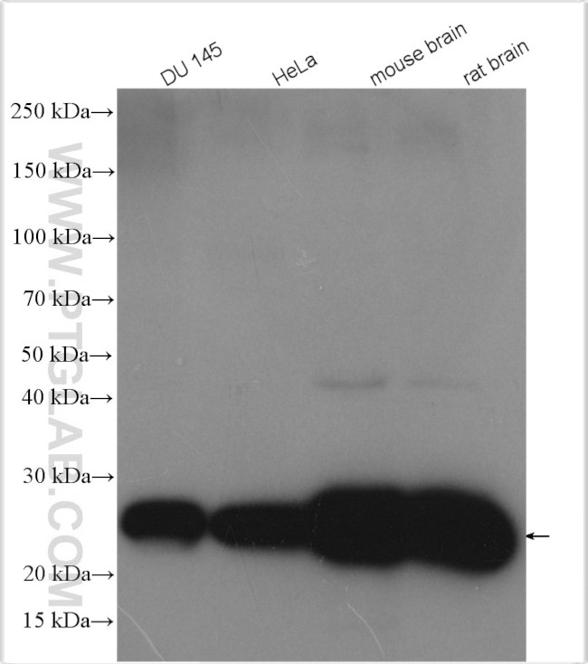 SOD2 Antibody in Western Blot (WB)