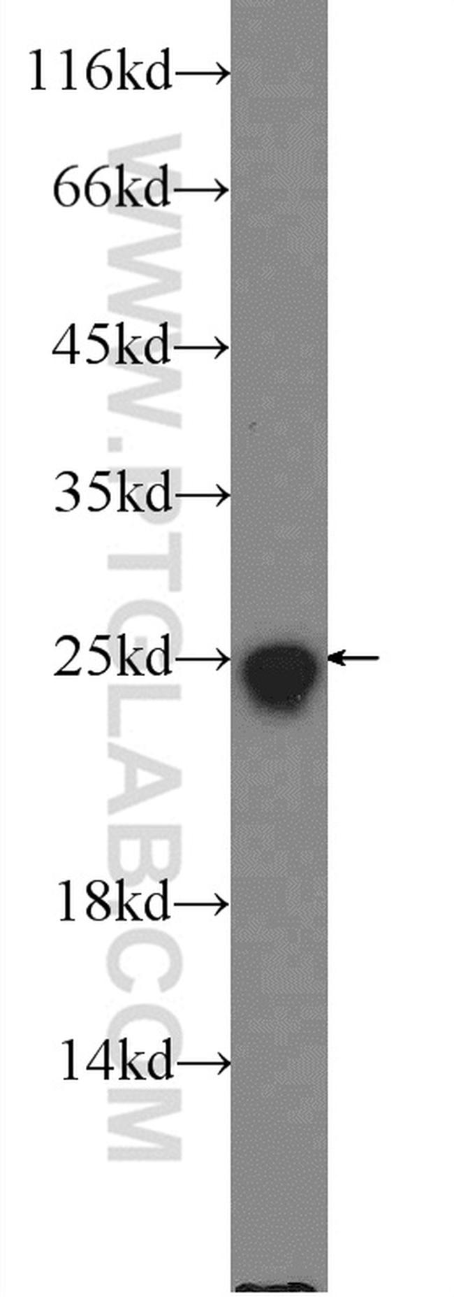 SOD2 Antibody in Western Blot (WB)