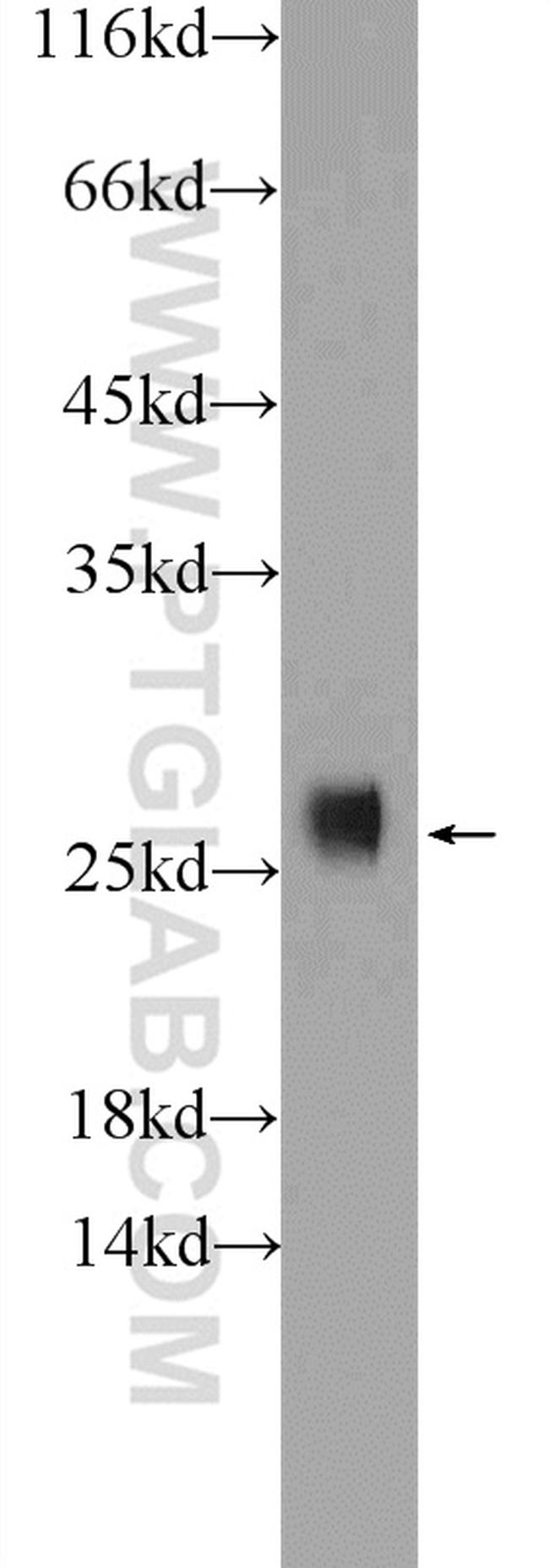 SOD2 Antibody in Western Blot (WB)