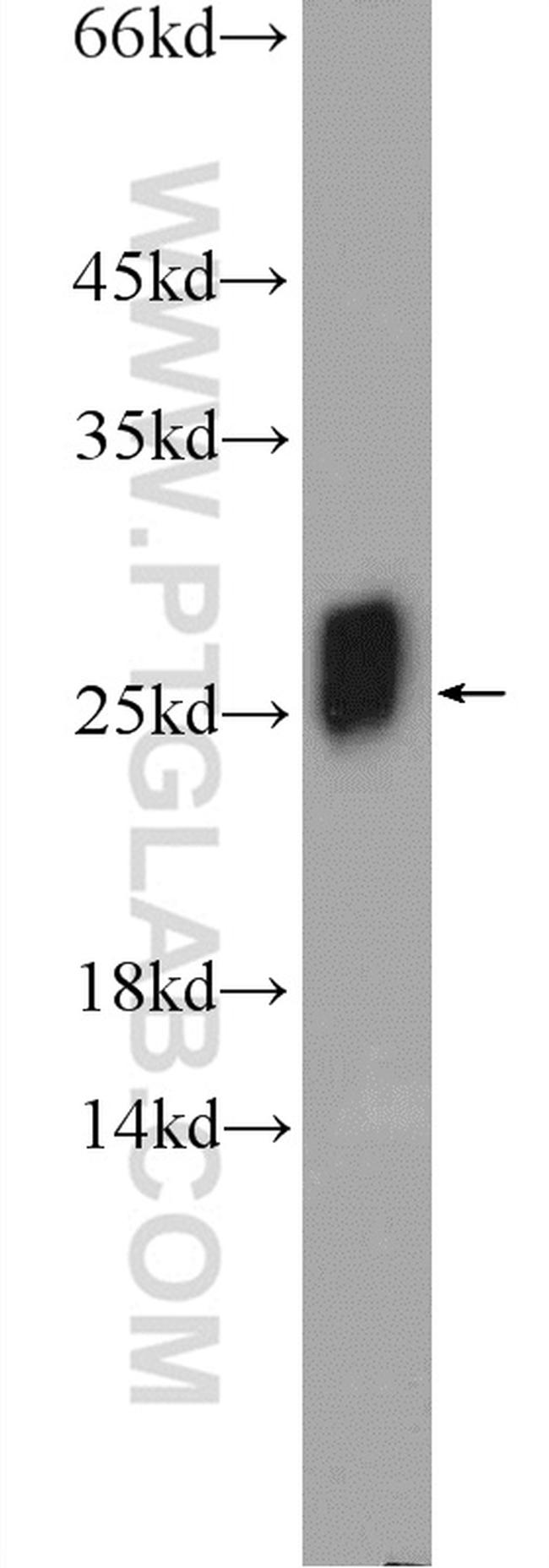 SOD2 Antibody in Western Blot (WB)