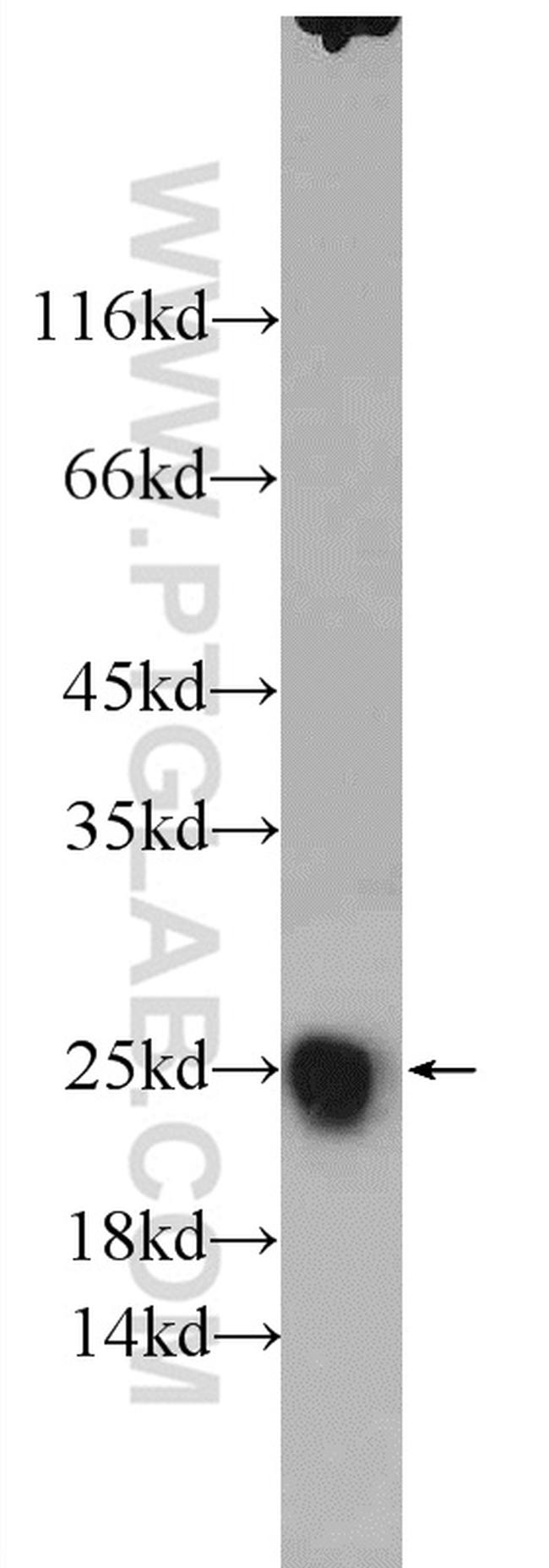 SOD2 Antibody in Western Blot (WB)