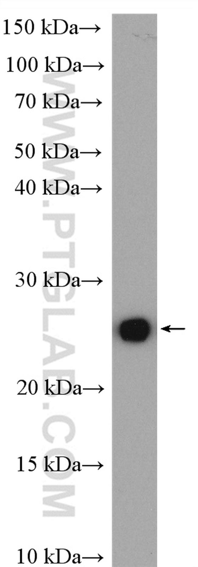 SOD2 Antibody in Western Blot (WB)